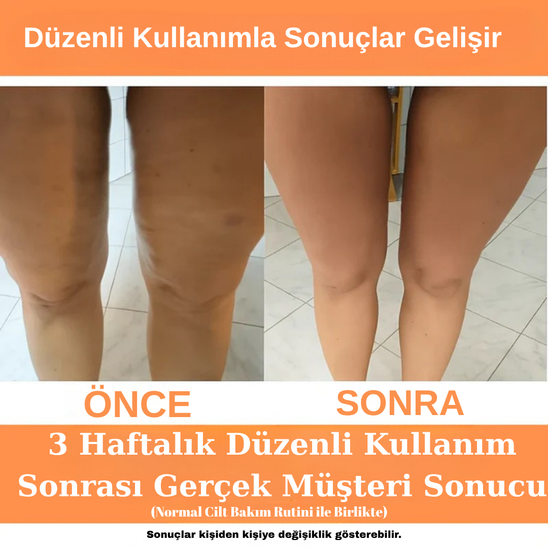 DuruRoll™ Selülit Giderici Masaj Aleti